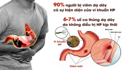 Sự thật ít biết về vi khuẩn HP