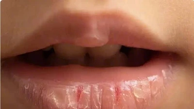 Vì sao dưỡng môi nhiều vẫn không hiệu quả?