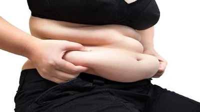 Mỡ bụng tích tụ âm thầm, hiểm họa không thể xem thường