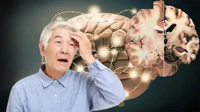 Cảnh giác với dấu hiệu sớm của Alzheimer