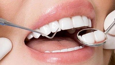 Tiền mất tật mang vì răng sứ giá rẻ