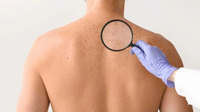 Phòng ung thư da, lão hóa sớm từ bên trong