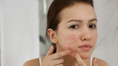 Tổn thương da vì dùng mỹ phẩm không đúng hướng dẫn