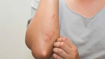Giải mã lý do nhiễm khuẩn đường huyết có tỷ lệ tử vong cao