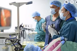 Cụ ông 72 tuổi bị stent di lệch gây tắc mật
