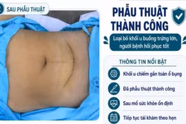 Ăn mau no, bụng ngày càng to, nữ sinh 17 tuổi phát hiện khối u khổng lồ
