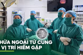 Hiếm gặp: Thai làm tổ giữa hai lớp dây chằng rộng