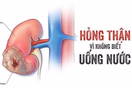 Bác sĩ cảnh báo nguy cơ tổn thương thận trong mùa hè vì uống nước sai cách
