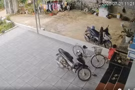 Hụt chân ngã từ bậc hè, trẻ bị chấn thương lách độ III