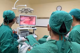 Đau bụng, ăn kém không ngờ ung thư đại trực tràng