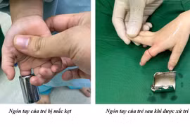 Cứu bé 4 tuổi kẹt tay trong ống sắt