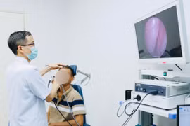 Chảy máu mũi suốt một tháng, thanh niên 18 tuổi tá hỏa khi thấy 'sinh vật lạ'