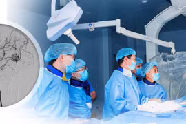 Hai trẻ xuất huyết não do dị dạng mạch máu được nút tắc thành công