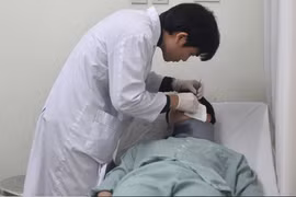 Tiêm filler tạo hình tai, 3 năm sau cô gái 24 tuổi nhập viện vì áp xe 