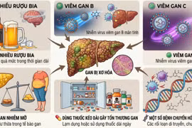 Xơ gan gia tăng, nhiều người nhập viện vì kiêng đạm sai cách