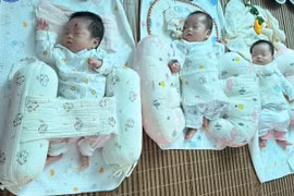 10 ngày sản phụ mang tam thai mổ lấy thai, viêm ruột thừa, xoắn phần phụ