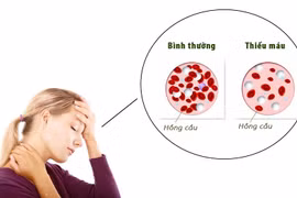 Ung thư máu, hiểu đúng để không hoang mang