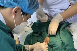 Sốt, nôn bé 1 tháng tuổi sốc nhiễm trùng, suy đa tạng nguy kịch