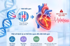 Ngất không rõ nguyên nhân, cảnh giác rối loạn nhịp tim do gene