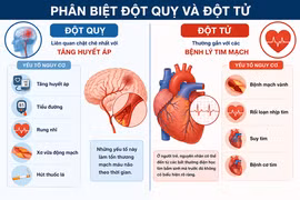 Phân biệt đột quỵ và đột tử trong những phút đầu sinh tử