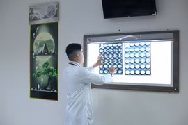 Ho ra máu đỏ tươi, người đàn ông 65 tuổi được cứu nhờ nút động mạch