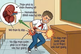 Ngã khi nô đùa, bé trai nhập viện vì chấn thương thận nghiêm trọng