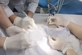 Dùng cờ lê làm 'vòng', nam thanh niên phải nhập viện cấp cứu