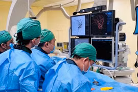 Đau đầu dữ dội khi đang ngủ, người phụ nữ 50 tuổi vỡ túi phình não