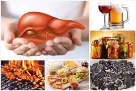 3 thói quen ăn uống âm thầm khiến gan nhiễm mỡ, tăng nguy cơ ung thư