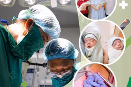 Ca đặc biệt trong sản khoa, dây rốn song thai xoắn chặt 'tác phẩm tết tóc'