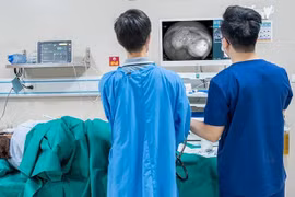 Đại tiện thất thường do polyp đại tràng tiến triển ung thư