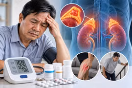 Tăng huyết áp uống 3-4 loại thuốc vẫn cao: Coi chừng bệnh tuyến thượng thận