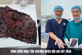 Rối loạn tiêu hóa phát hiện tổn thương tiền ung thư trực tràng