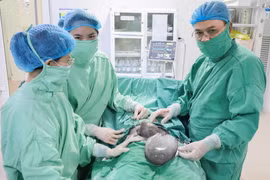 Lấy u buồng trứng to hơn cả thai nhi trong 1 lần mổ