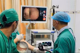 Uống nước, người đàn ông 51 tuổi nuốt luôn hàm răng giả dài 6 cm
