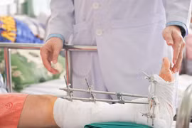 Cách sơ cứu, xử lý chi đứt lìa do máy cắt cỏ 