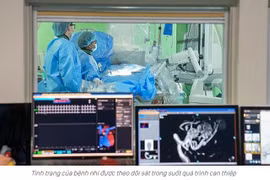 Bé 8 tuổi yếu liệt dần hai chân, phát hiện dị dạng mạch máu tủy sống phức tạp