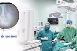 Phẫu thuật cấp cứu thành công vỡ áp xe phần phụ nguy hiểm