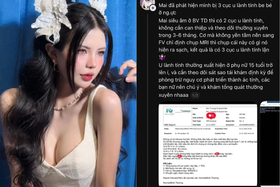 'Nữ MC nóng bỏng nhất làng game' Mai Dora bất ngờ tiết lộ có khối u ở ngực