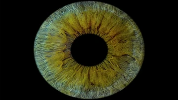 Ca ghép giác mạc in 3D đầu tiên trên người, giúp bệnh nhân mù lấy lại thị lực