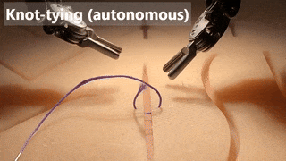 Robot phẫu thuật tự động "không một sai xót"