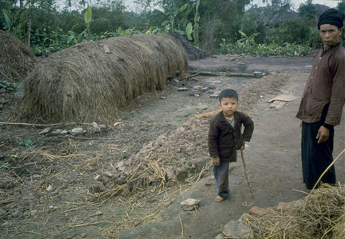 Một em bé ở khu vực ngoại ô bị mất chân do bom Mỹ đứng cùng bố trên đường làng. Em sử dụng một khúc cây làm nạng.