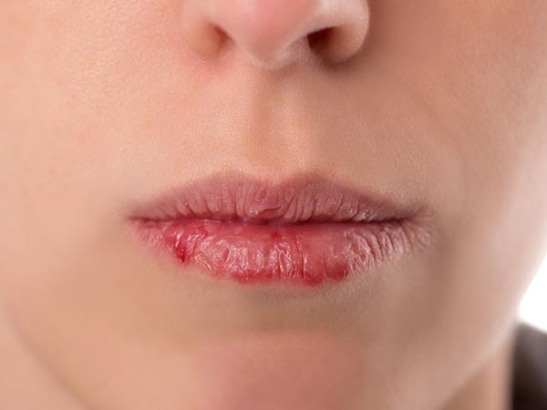 Kem dưỡng môi không chỉ dành riêng cho phụ nữ. Đàn ông có đôi môi khô nứt cũng gây mất cảm quan đối với phụ nữ. Vì thế đừng ngại mang theo dưỡng môi nếu môi bị khô.
