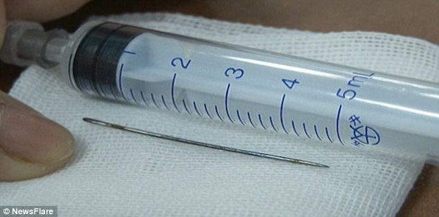 Dị vật được lấy ra là một cây kim khá to. Sức khỏe của em bé sau khi được xử lý hóc dị vật vẫn bình thường.