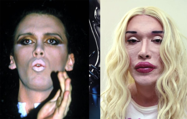 Huyền thoại nhạc pop của những năm 80 Pete Burns thú nhận đã phải trải qua hơn 300 lần phẫu thuật tái tạo hình sau khi phẫu thuật thẩm mỹ hỏng. Chủ nhân của ca khúc “Dead or Alive” 57 tuổi đã từng suýt chết và nỗi sợ hãi này vẫn chưa qua.