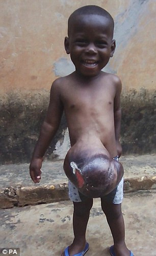 Vào năm 2015 một bác sĩ người Anh tên là David Williams đã đến Ghana thăm con gái đang dạy tiếng Anh và làm phát thanh viên tại nước này đã tình cờ gặp Charles, bố của bé Ethan và được nhờ khám cho cậu bé.