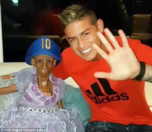 Một cô bé người Colombia 15 tuổi trong thân hình của một bà lão 90 tuổi đã đạt được ước mơ gặp thần tượng bóng đá của mình là cầu thủ James Rodriguez, thậm chí còn được hôn lên má thần tượng.