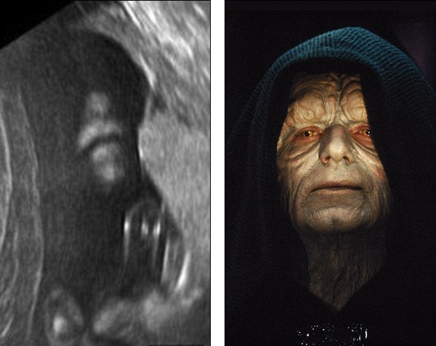 Một hình ảnh siêu âm khác giống y hệt thần bóng tối Darth Sidious.