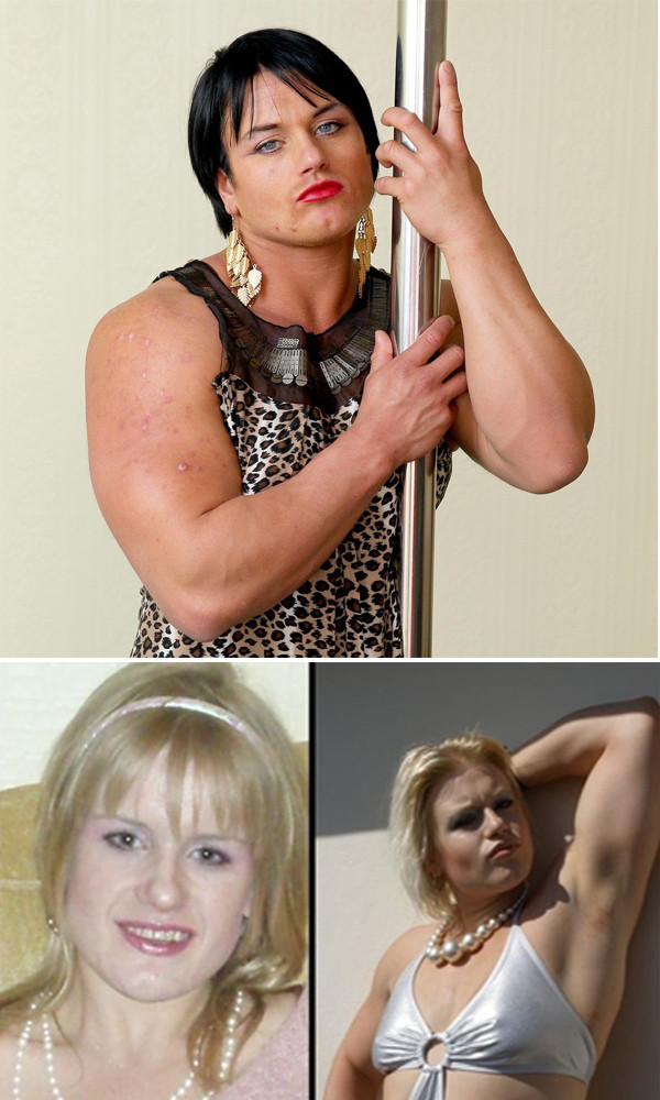 Cô nhân viên làm việc ở quán rượu Candice Armstrong, 28 tuổi ở Walthamstow (London) là người đã lạm dụng steroid và hậu quả là bất đắc dĩ trở thành đàn đông. Từng là một cô gái gợi cảm xinh đẹp tóc vàng, Candice giờ đây trở thành một người ngăm đen to lớn với cơ bắp và lông mọc đầy người từ lưng đến ngực và mép. Chưa kể vùng kín bỗng nhiên sưng vù trông như vùng kín của đàn ông.