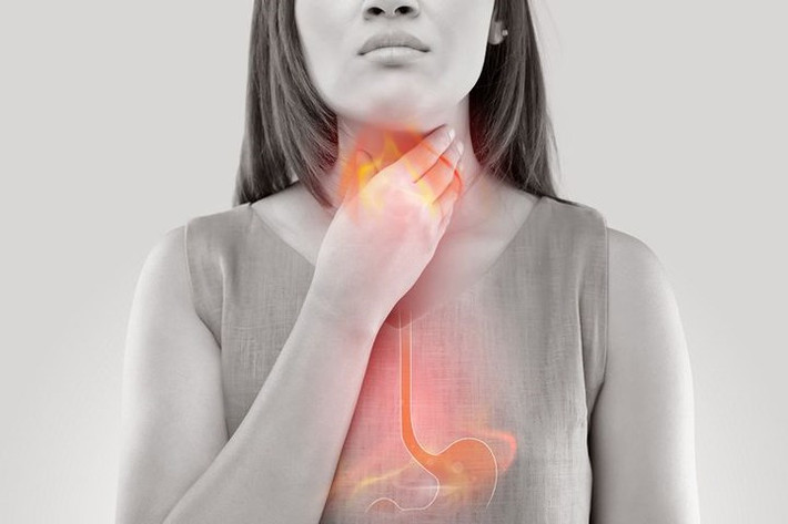 Trào ngược axit: Trào ngược dạ dày thực quản (GERD) có thể gây buồn nôn do axit dạ dày tăng lên và tràn ra khỏi dạ dày vào thực quản dưới. Axit này có thể làm hỏng lớp lót thực quản của bạn, có thể khiến bạn cảm thấy buồn nôn. Các triệu chứng phổ biến khác của trào ngược axit bao gồm đau ngực, ợ nóng, khó nuốt thức ăn, hoặc cảm thấy như bạn có một cục u trong cổ họng.